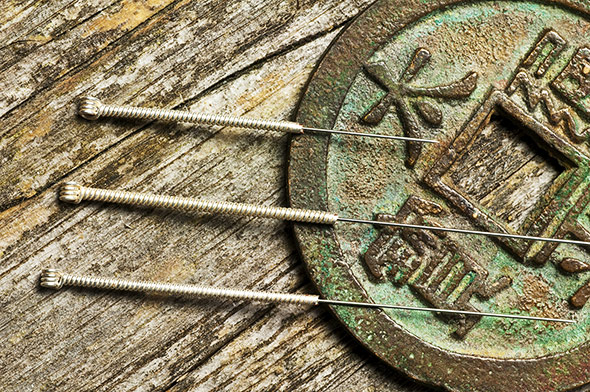 Akupunktur - Chinesische Heilkunst mit langer Tradition