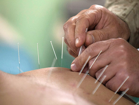 Die Lage der Akupunkturpunkte lässt sich bisher nicht konsistent einer anatomischen Struktur zuordnen.