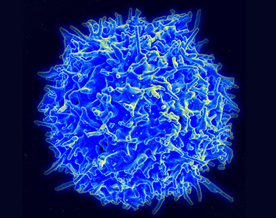 Elektronenmikroskopische Aufnahme einer menschlichen T-Zelle