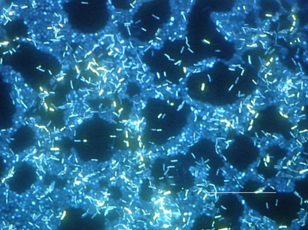 Geschützt durch die umhüllende Schleimschicht des Biofilms, können Bakterien sogar vermeintlich abweisende Oberflächen besiedeln, hier eine Edelstahloberfläche.