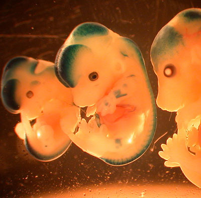 Mäuseembryonen verschiedenen Alters