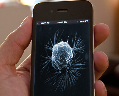 Noch Zukunftsmusik: die Krebsprognose auf den Smartphone