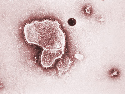 Elektronenmikroskopische Aufnahme eines RS-Virus