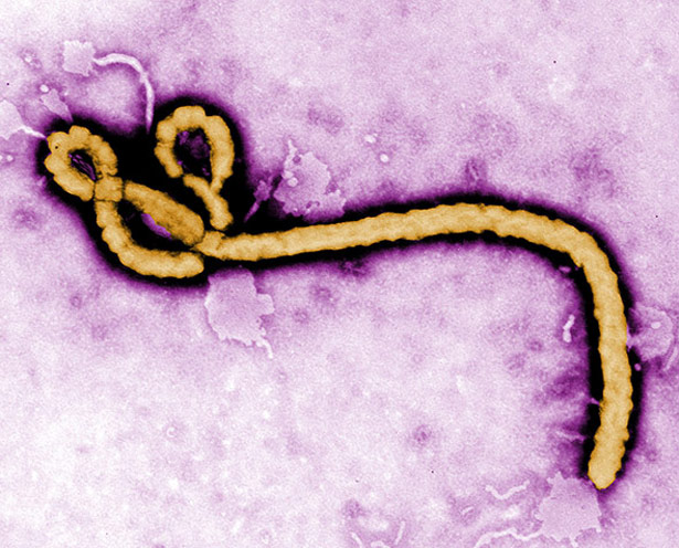 Fledermäuse in Westafrika tragen mitunter das Ebola-Virus in sich - bei uns verbreiten die Tiere mit Ausnahme von Tollwut dagegen keine gefährlichen Krankheiten.