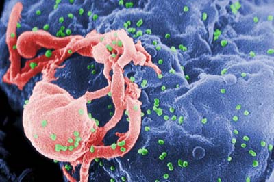 HIV-1 Virus an Lymphozyt