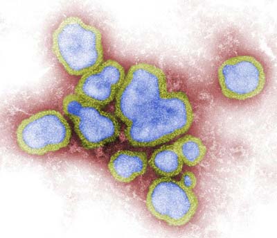 Influenza A Virionen