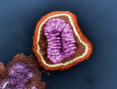 Kann sich schnell verändern: das Grippevirus