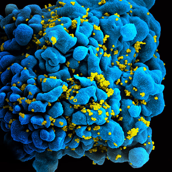 HI-Viren (gelb) haben eine menschliche T-Zelle infiziert