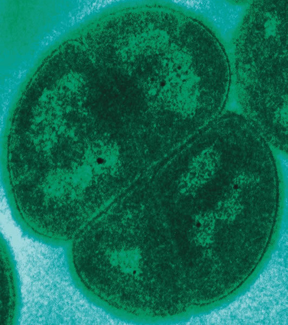 Überlebenskünstler: Das Bakterium Deinococcus radiodurans