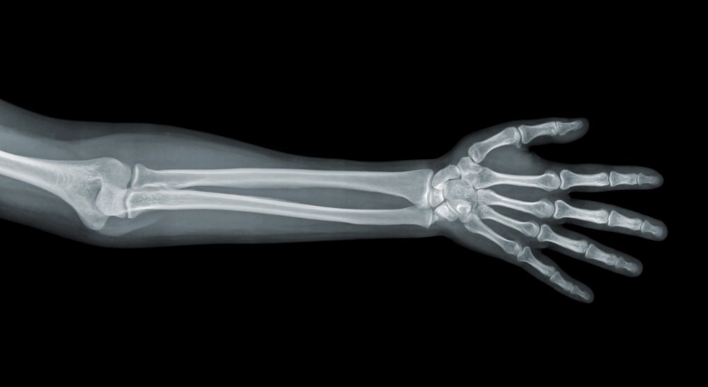 Die Entdeckung der Röntgenstrahlung eröffnete ganz neue Einsichten in vielen Bereichen. © eAlisa/ istock