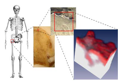 Neu entdecktes Blutgefäßsystem in Knochen › Medizinische Fakultät