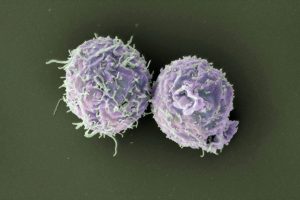 Modifizierte T-Zellen