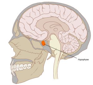 Hypophyse