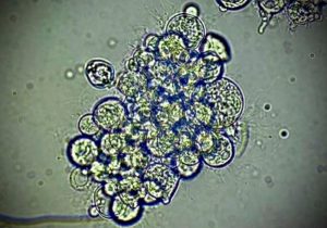 Sporenbildende Strukturen des Bd-Pilzes unter dem Mikroskop