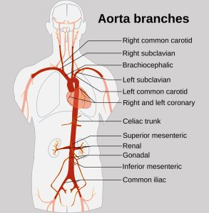 Aorta und abzweigende Arterien