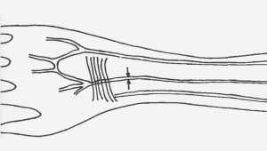 Median-Arterie