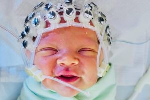 Lächelndes Baby trägt eine Haube mit EEG-Elektroden
