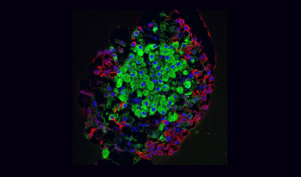 Tenemos dos tipos de células beta: el páncreas contiene dos subtipos de células productoras de insulina.