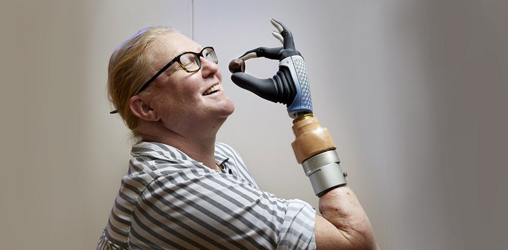 bionische Handprothese