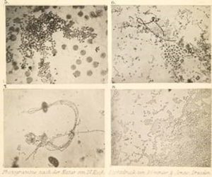 erste Bakterienfotos