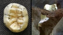 fossiler Zahn