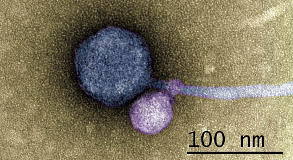 Ein koloriertes Bild des neu entdeckten Satellitenvirus, das an sein Helfervirus gekoppelt ist.