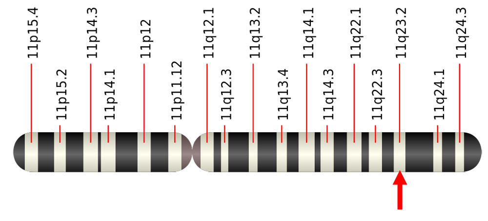 Chromosome 11