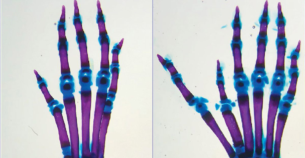 How mutated 'gene switches' can lead to extra fingers Changes in gene regulation can disrupt physical development
