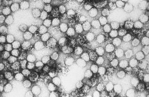 Mikroskopaufnahme von Gelfieber-Viren