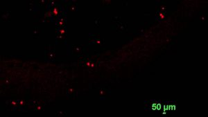 Fluoreszierende Plastik-Partikel