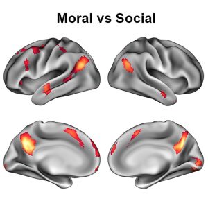 Hirnscans zeigen aktive Hirnareale bei der Bewertung von moralischen Werten und sozialen Normen