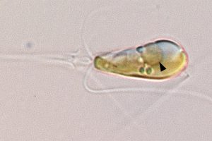 Mikroskopaufnahme einer Algenzelle mit einem Nitroplasten