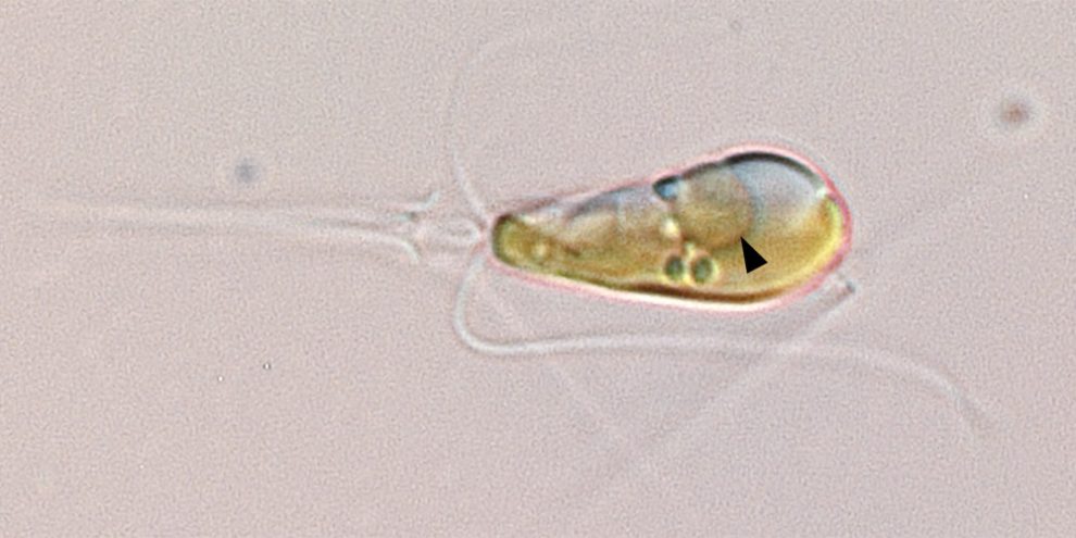 Mikroskopaufnahme einer Algenzelle mit einem Nitroplasten