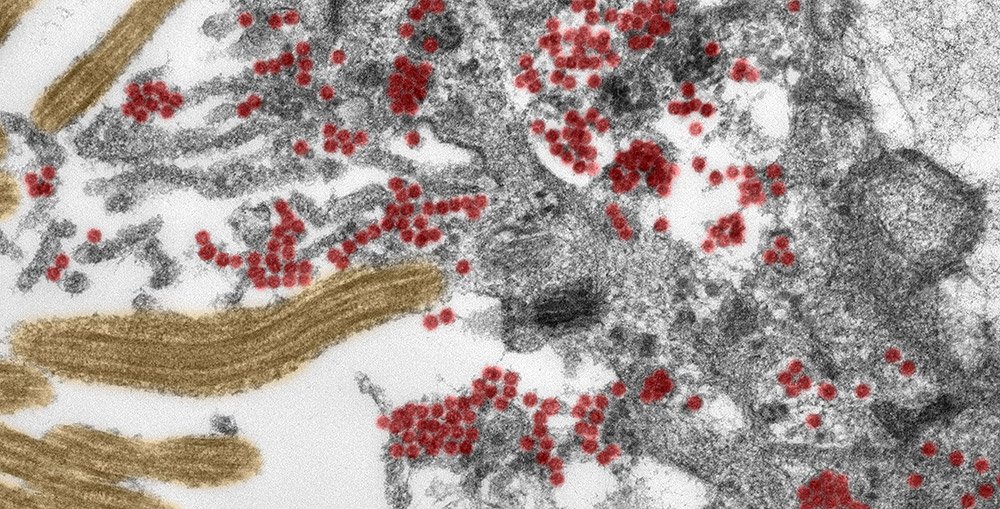 Photo of Wie SARS-CoV-2 in das Gehirn gelangt – Riechzellen sind ein Tor für das Coronavirus, um in das Nervensystem einzudringen