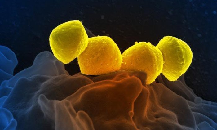 Streptococcus pyrogenes