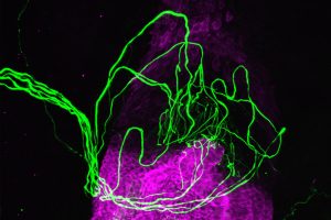 Angefärbter menschlicher Haarfollikel umgeben von einem sensorischen Nervenende