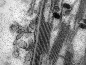 Thylakoidmembran