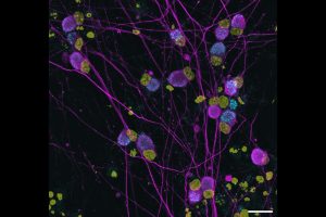angefärbte menschliche sensorische Neuronen