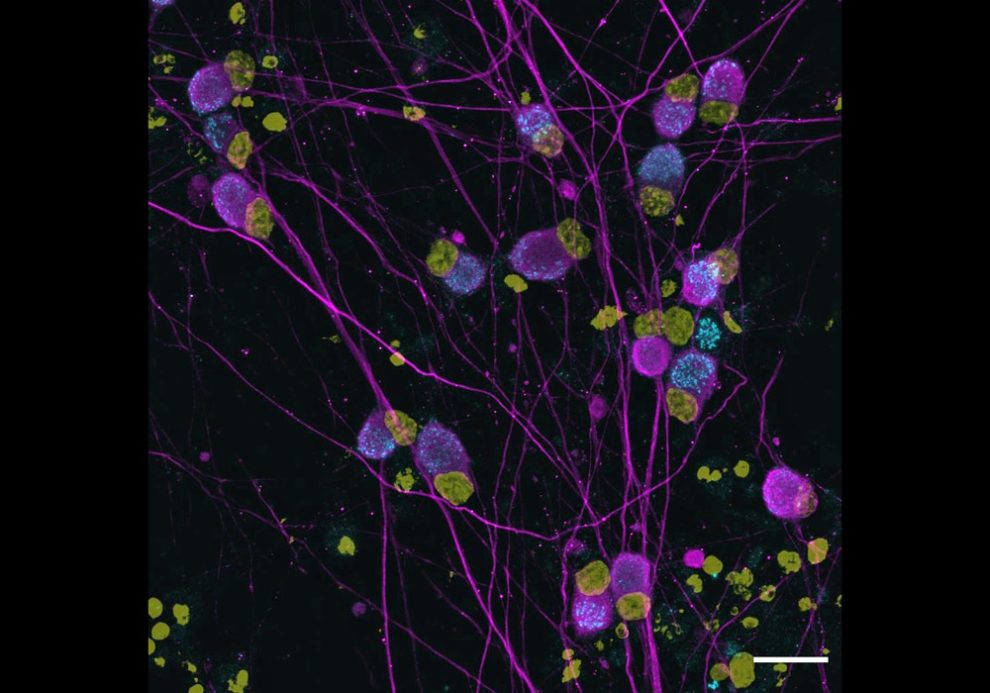 angefärbte menschliche sensorische Neuronen