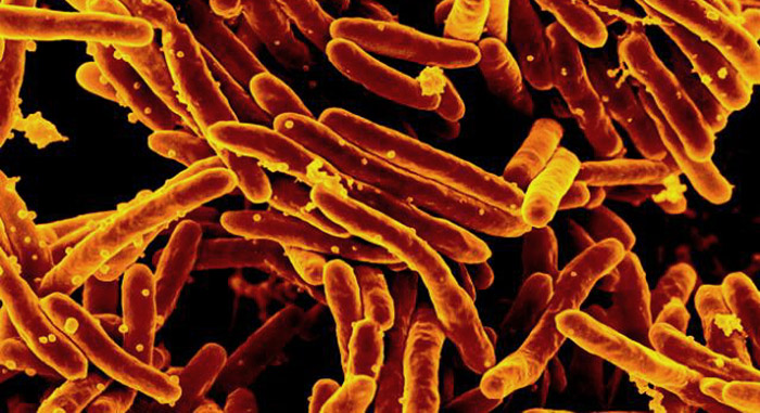 Mycabacterium tuberculosis