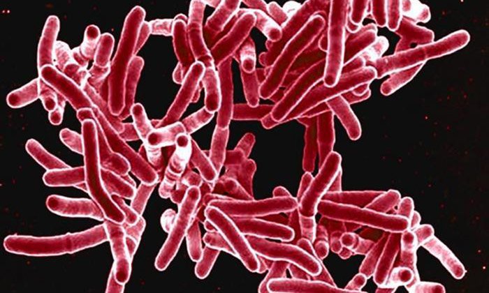 Tuberkulose-Bakterien