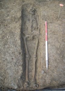 Ausgegrabenes Skelett einer Person mit dem Klinefelter-Syndrom