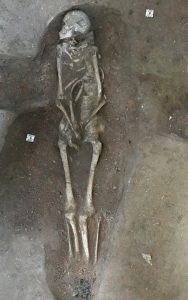 Ausgegrabenes Skelett einer Person mit Jacobs-Syndrom
